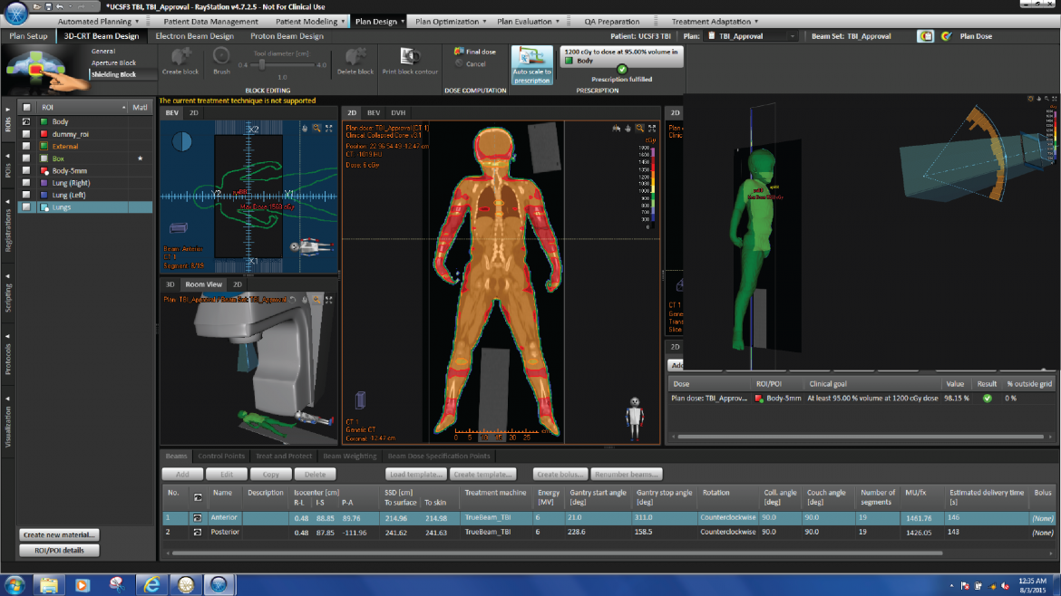 Tbi Radiotherapy Total body irradiation (TBI) - UCSF Department of Radiation Oncology