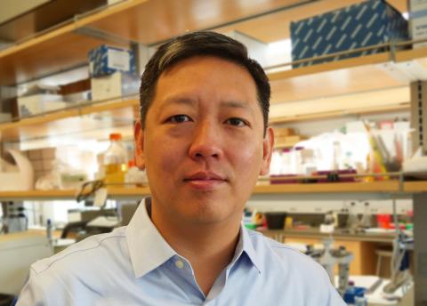 Dr. Felix Feng is a Senior Researcher on Promising New Prostate Cancer Study