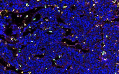 Here’s How to Prime Tumors to be Defeated by Cancer Immunotherapy