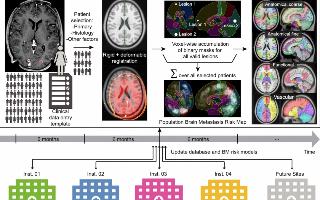 Multi-institutional atlas of brain metastases informs spatial modeling for precision imaging, personalized therapy