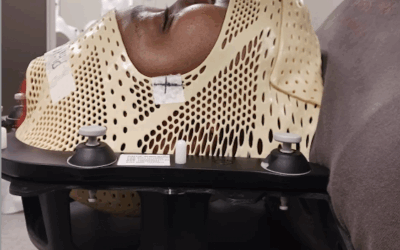 NBC News ft. David Raleigh – Is Depo-Provera birth control to blame for this woman’s brain tumor